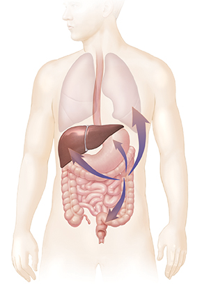Outline of body showing digestive and respiratory tracts, with arrows showing spread of cancer.